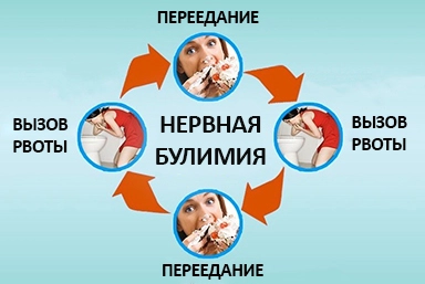 Лечение булимии в Старонижестеблиевской
